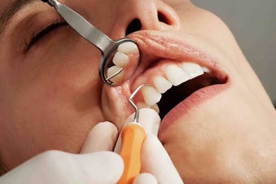 Cosmetic dentist in Encino